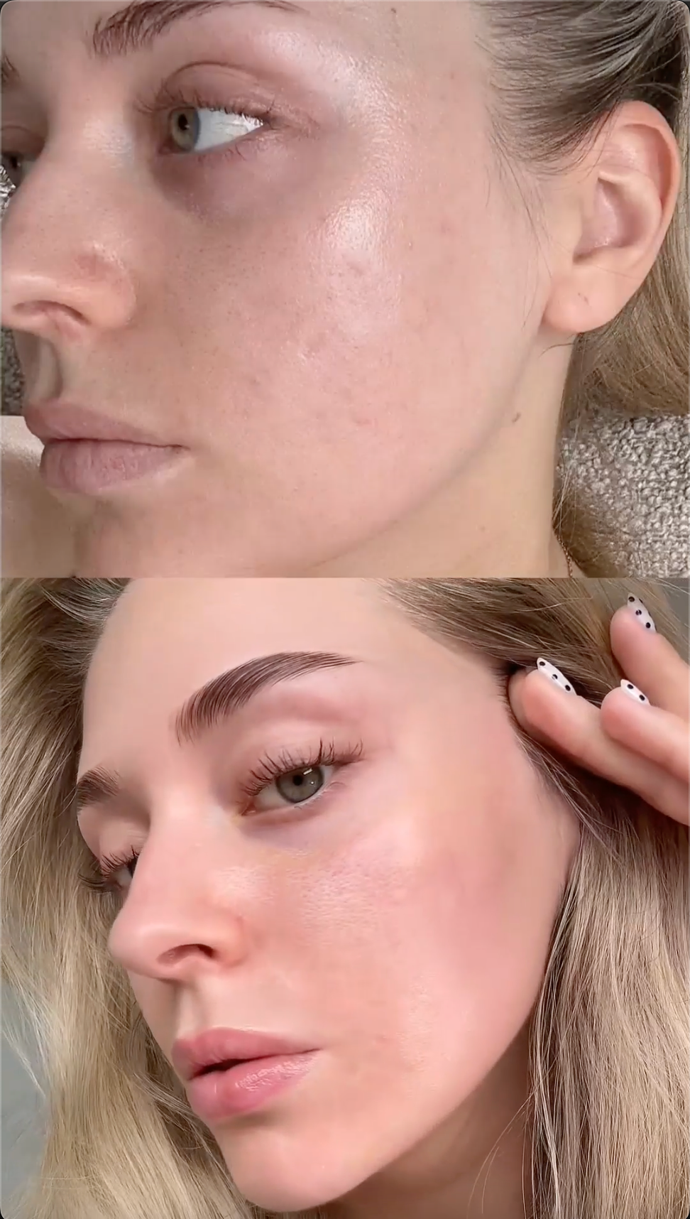 Luméa Retinal Shot Tightening Booster